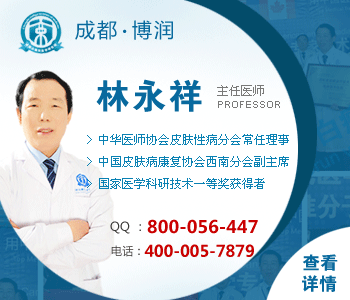 发生白癜风的不良习惯有哪些