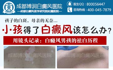 白癜风如何护理皮肤