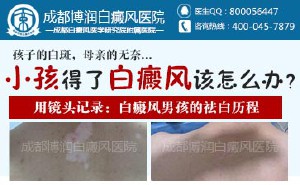 白癜风如何预防较好