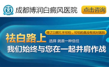 白癜风患者和家人要提高警惕